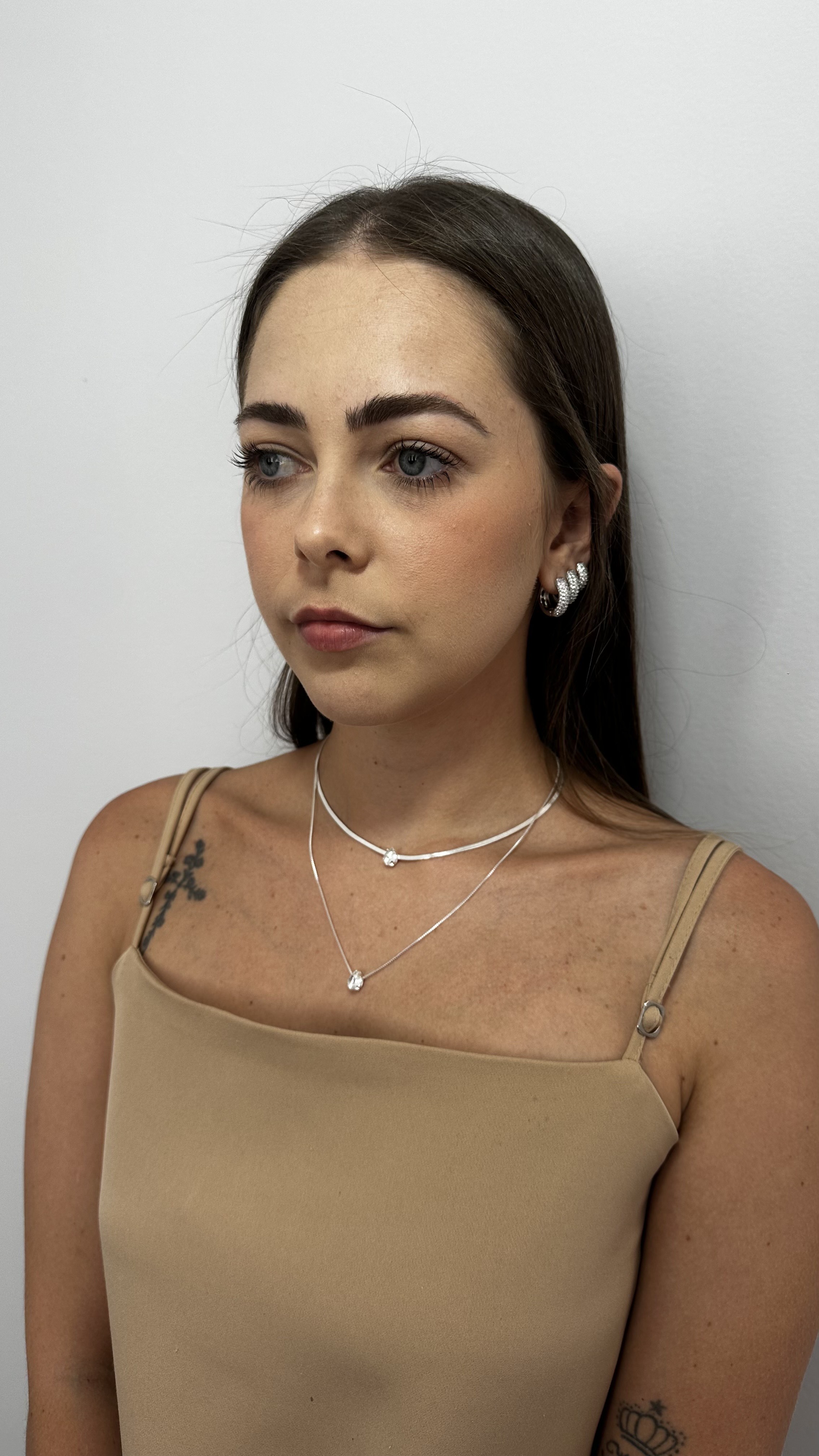 Antes - Perfiloplastia